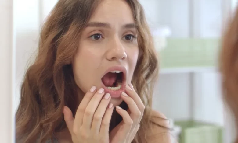 Alimentos e bebidas que deixam os dentes amarelados, segundo dentista