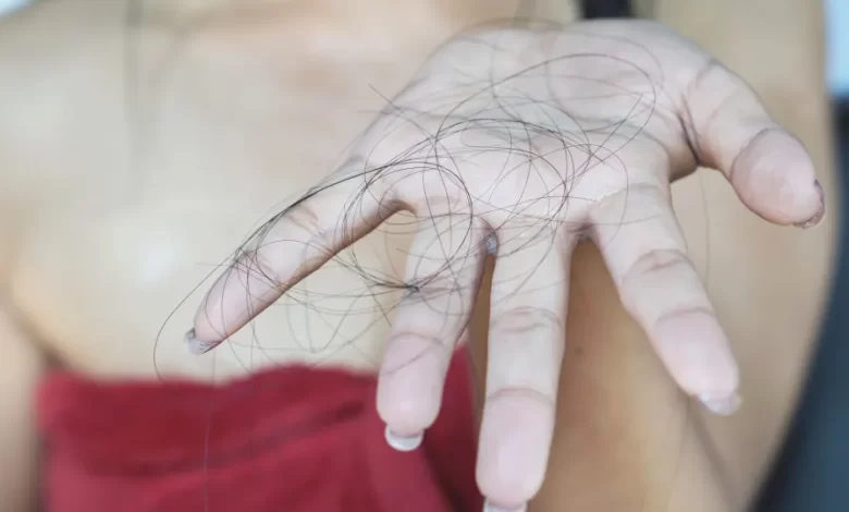 Calcário da água leva à queda de cabelo? Dermatologistas esclarecem