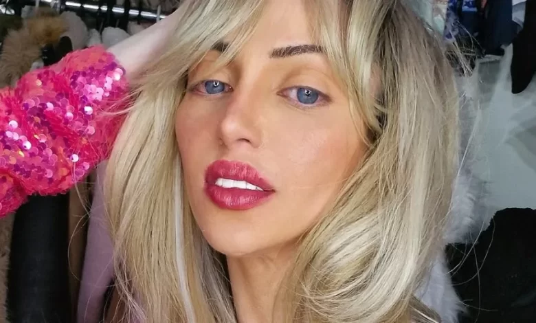 Revelada causa da morte de influencer chamada de "Barbie humana"